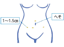 体ポート図