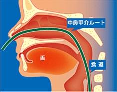 経鼻内視鏡(右画像)