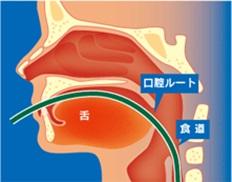 経口内視鏡(右画像)